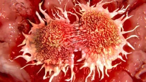 Vitamin C Deficiency Linked to Increased Risk of Stomach, Esophageal, and Lung Cancers: Key Symptoms to Watch For