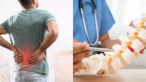 Is It a Slipped Disc? Spotting the Differences in Your Back Pain: Symptoms, Causes, and When to Seek Help