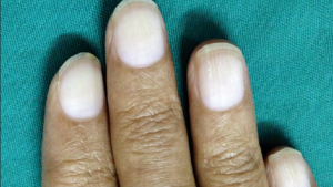 This everyday symptom could be a warning sign from the gut; here's why